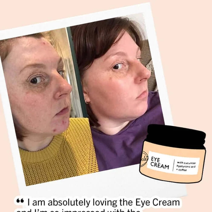 Eye Cream with Hyaluronic Acid & Coffee