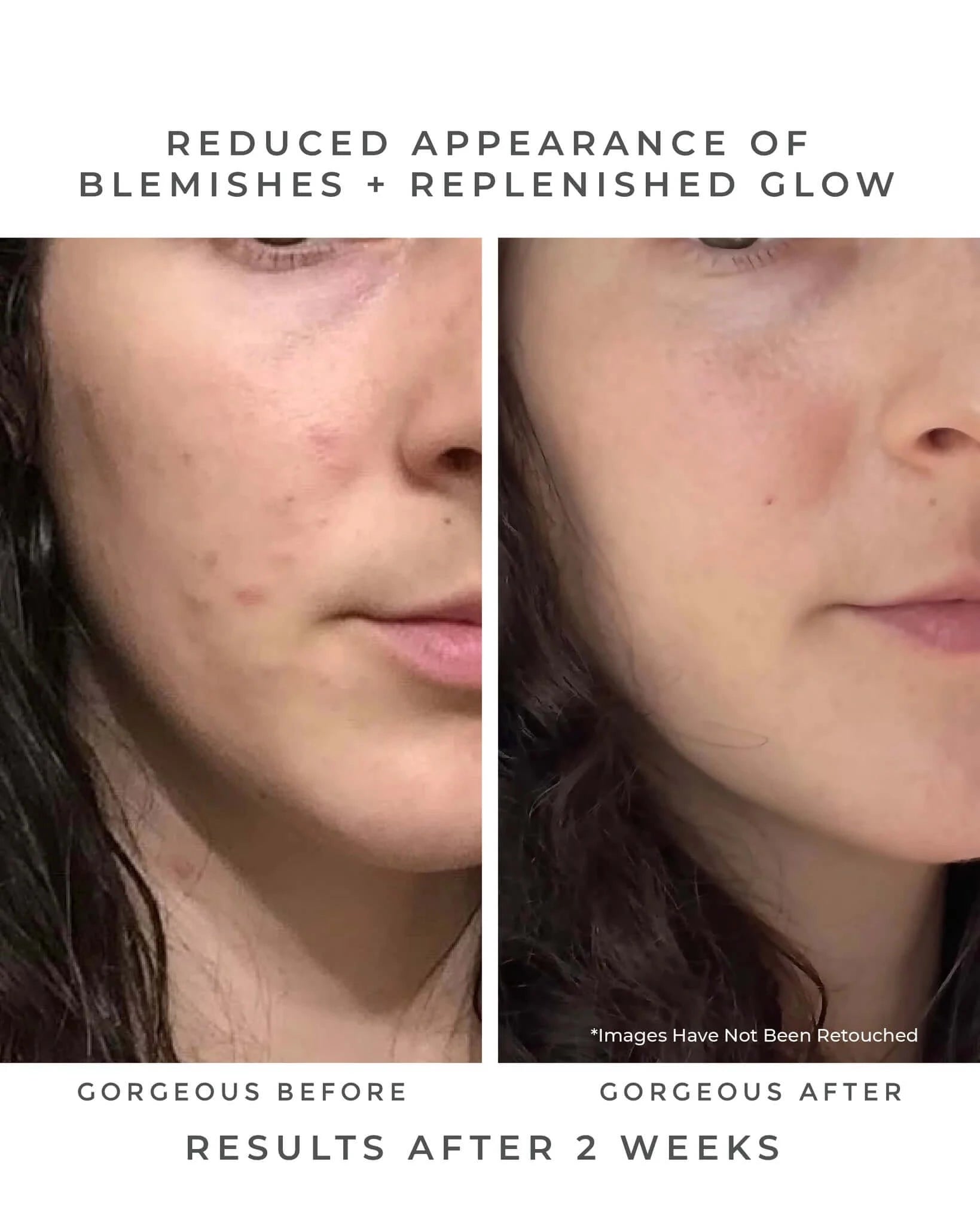 Oasis Deep Pore Gel Cleanser