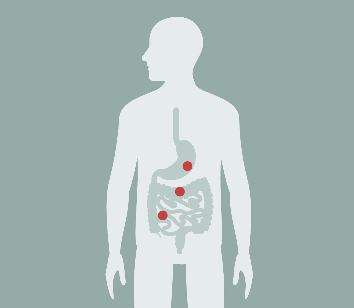 Do you Need a Parasite Cleanse?